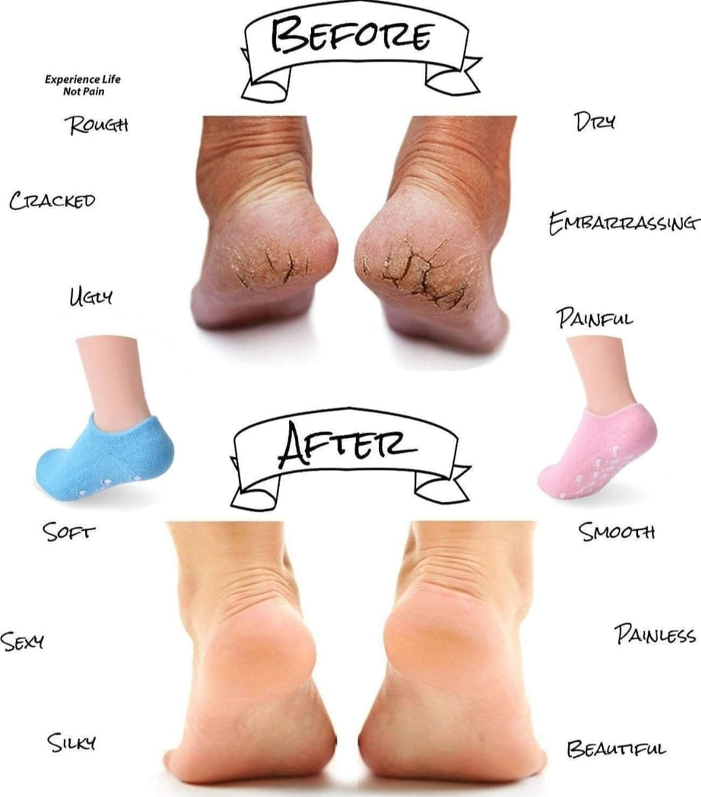 Moisturizing Spa Gel Socks for Soft, Hydrated Feet