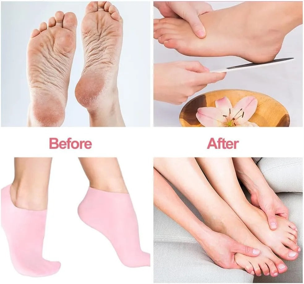 Silicone Socks – Buy 1 Get 2 Free (3-Pack)